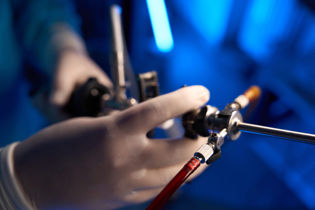 laparoscopy